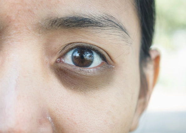 eyelid twitching causes