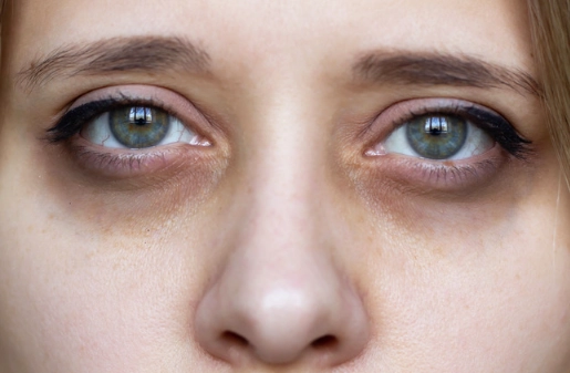 eye twitching sleep deprivation