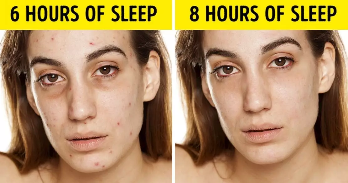 deep sleep deprivation symptoms