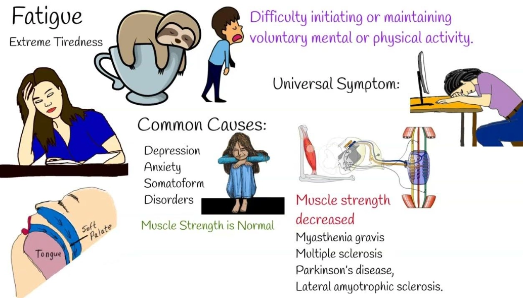 fatigue and autoimmune disease