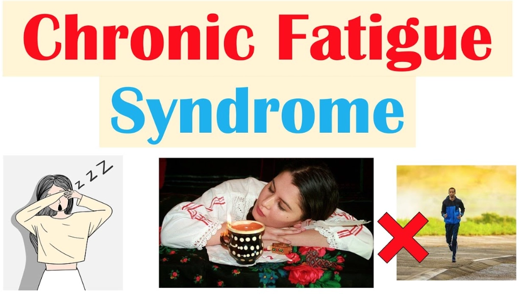 fatigue and autoimmune disease